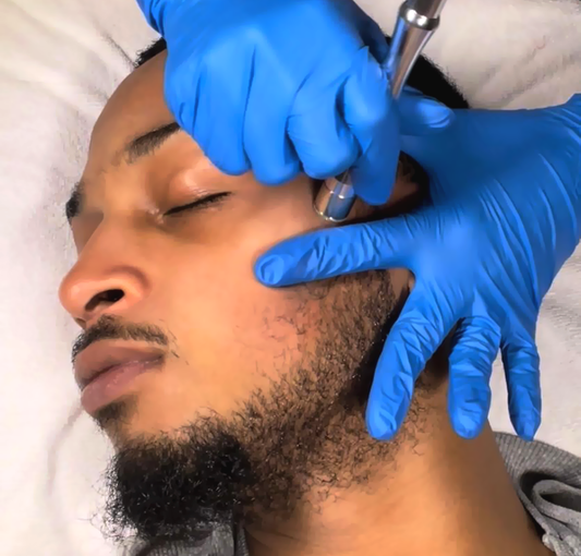 Close-up of a bearded black man's face receiving microdermabrasion from an esthetician using a tool and wearing blue latex gloves